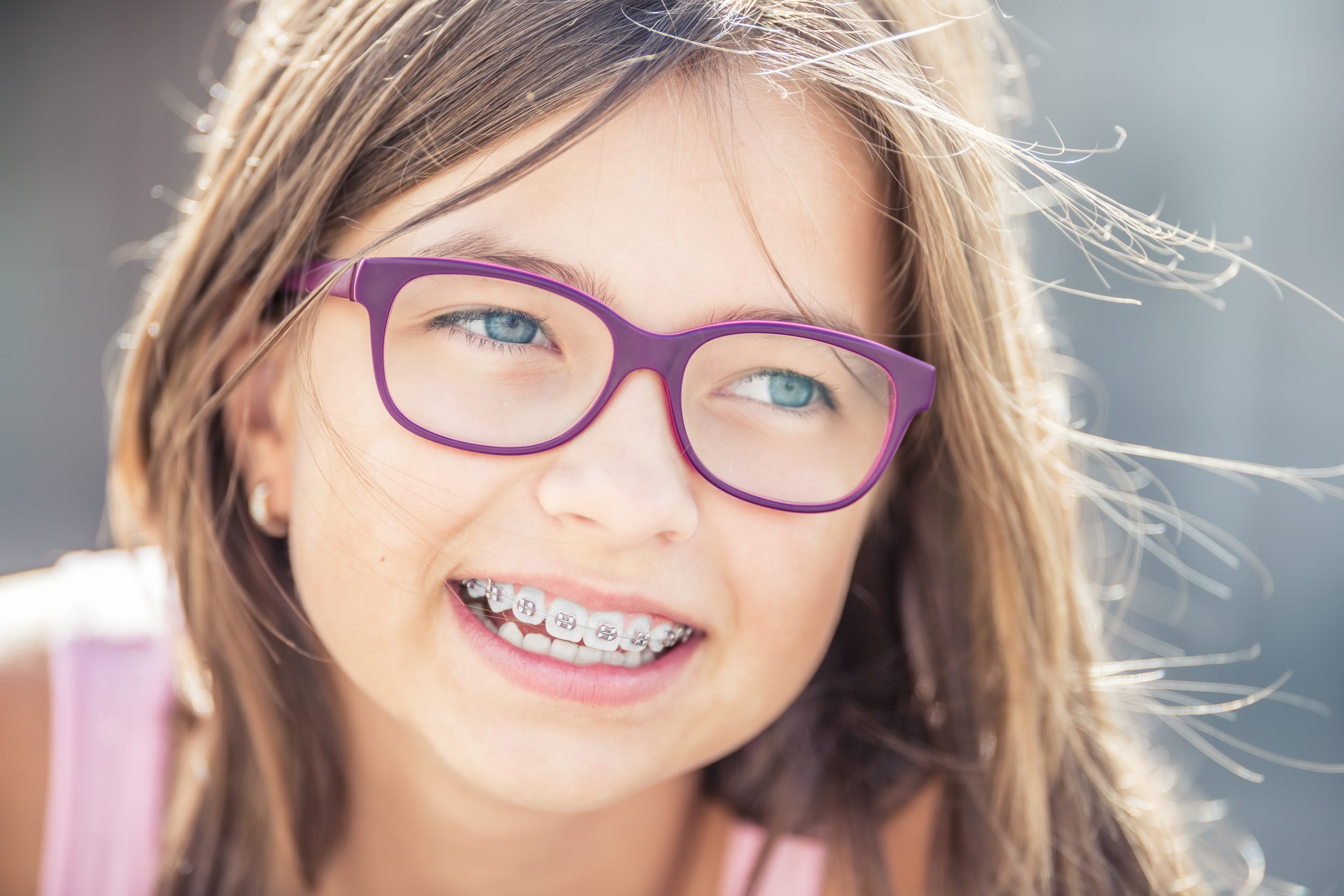 The Perfect Timing: Decoding the Best Age for Kids to Get Braces