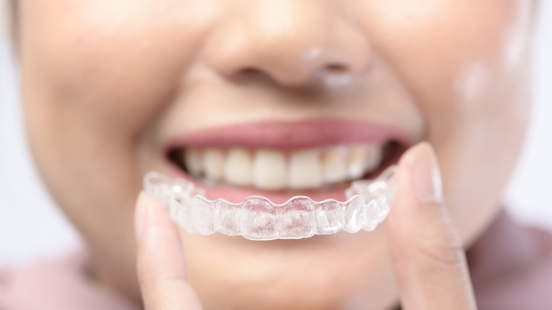 Invisalign Tarneit